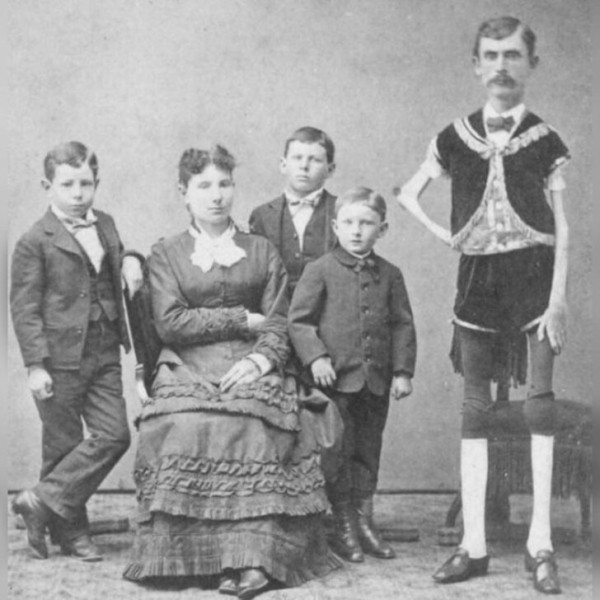 Трагическая история &laquo;живого скелета&raquo; Исаака Спрэга