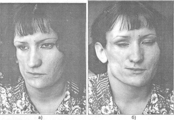 Странные медицинские состояня, которых определённо стоит опасаться