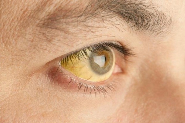 Вот это отдохнули! Опасные болезни, которые можно подцепить за границей Вот это отдохнули! Опасные болезни, которые можно подцепить за границей